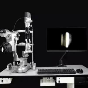 LENTE INTRAOCULAR